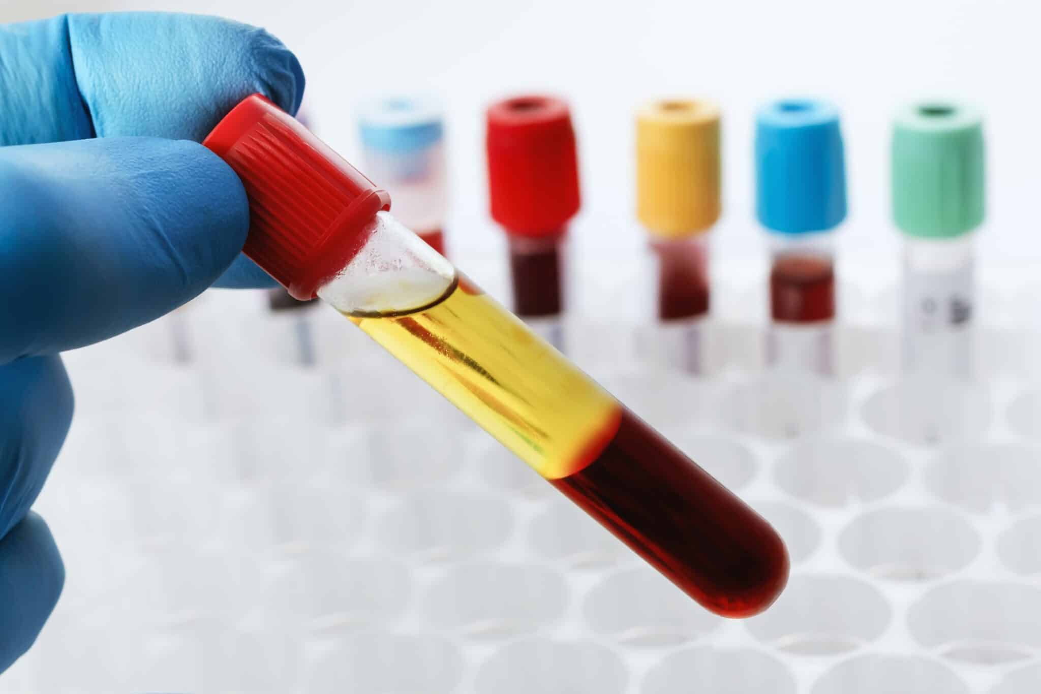 PRP therapy for women at FemRenew Toronto